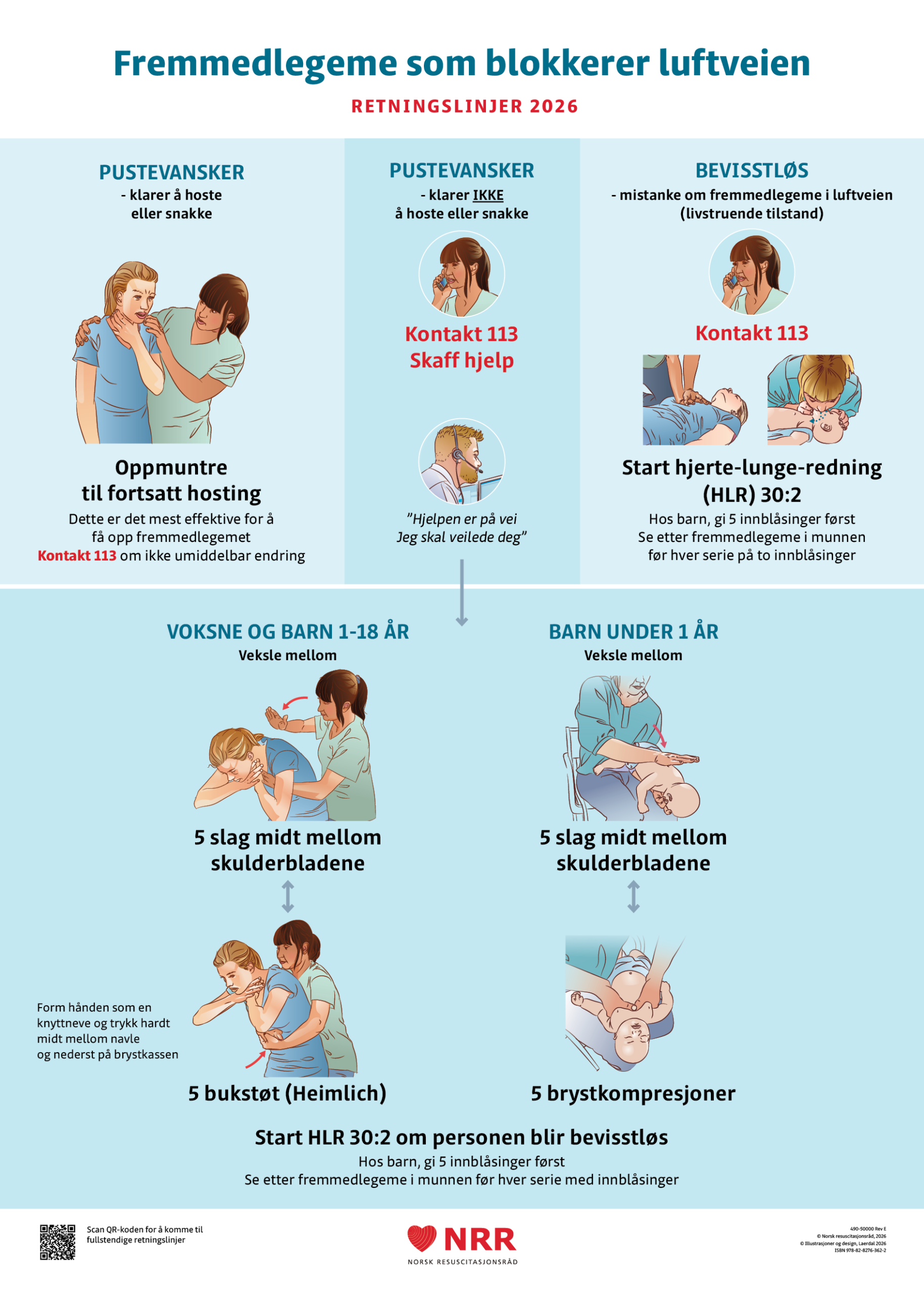 Fremmedlegeme luftvei